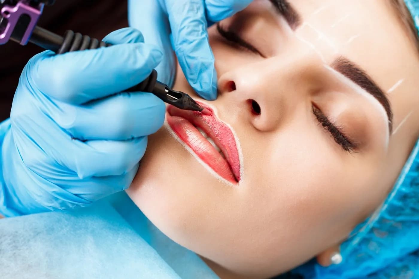 Tilburg'daki Charisma Clinic'te Dudaklar