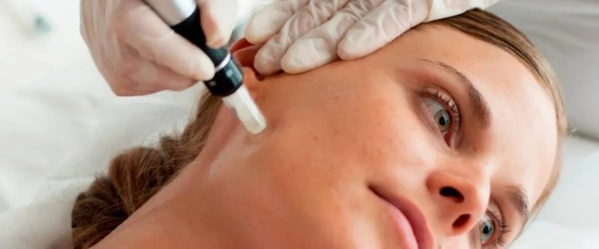 ميكرونيدلنج في عيادة كاريزما بتيلبورخ